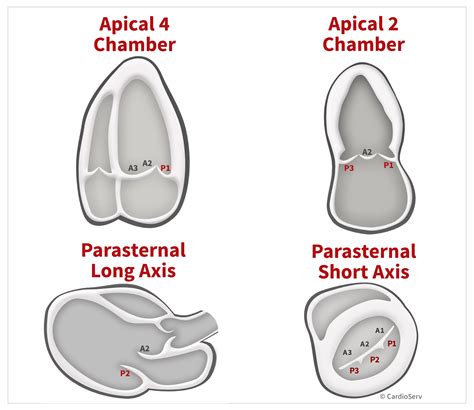 Mitral Valve Orientation in Echo: Anatomy & Scallops Expained!