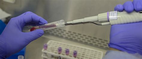 Molecular Genetics Lab 的图像结果