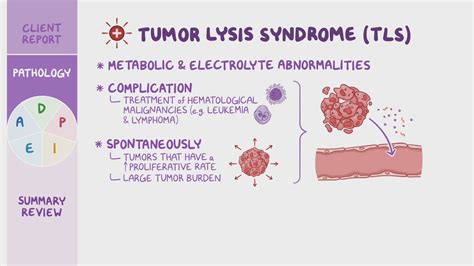 Tumor Lysis Syndrome Tumour Lysis Syndrome — The Intern At Work