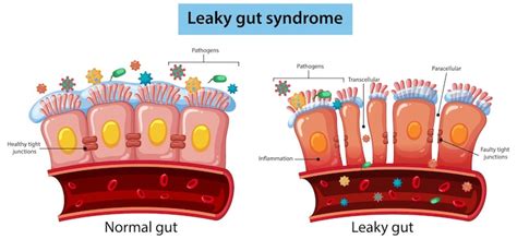 Inflammation Images - Free Download on Freepik