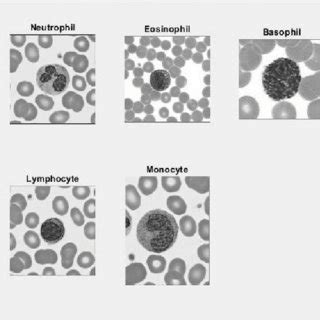 Image result for WBC Count Microscope