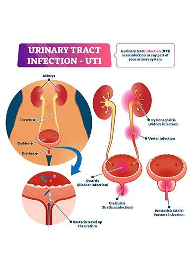 Top Urology Hospital in Vijayawada | Kidney & Urinary Care ...