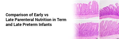Comparison of Early vs Late Parenteral Nutrition in Term and Late ...