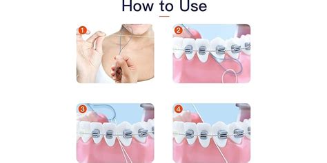 Image result for Using a Floss Threader