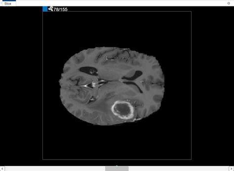 Image result for Volume Segmenter MATLAB Tutorial