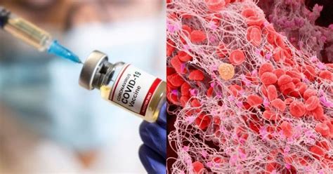 AstraZeneca, Johnson & Johnson Covid Vaccines Cause Blood Clots: Should ...