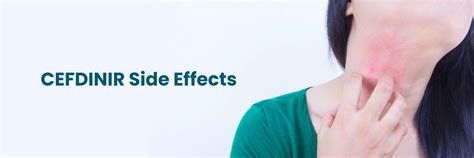 Cefdinir Side Effects: Common, Severe, and Allergic Reactions