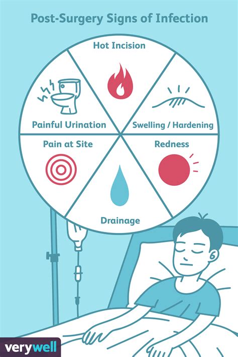 Signs and Symptoms of an Infection After Surgery