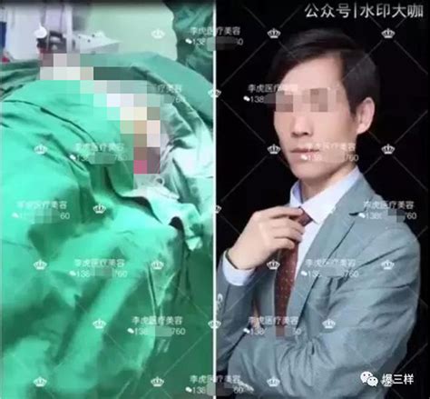 女子丰胸视频被整容医师无码分享 工商局：涉嫌违规_凤凰网
