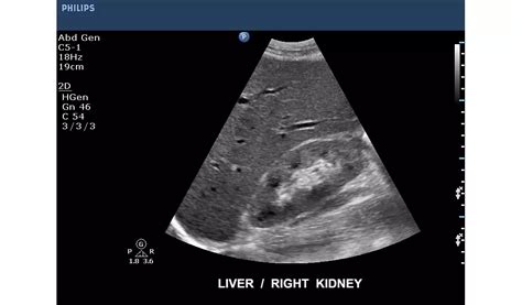 Philips - CX50 POC Ultrasound system