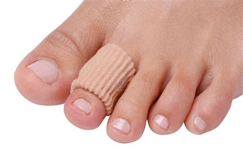 Hammer toe | Causes, Diagnosis and Treatment | The Foot Hub