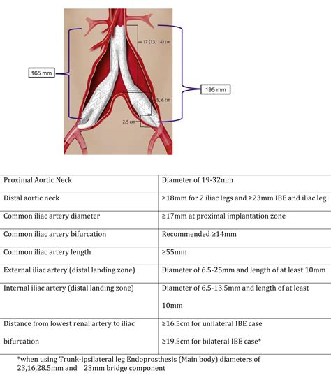 Gore Iliac Branch Endoprosthesis for treatment of bilateral common ...