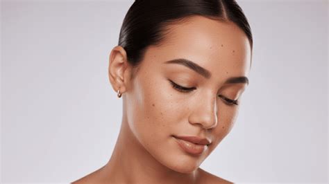 Flat Mole Removal: Safe Expert Methods - Obviousmag