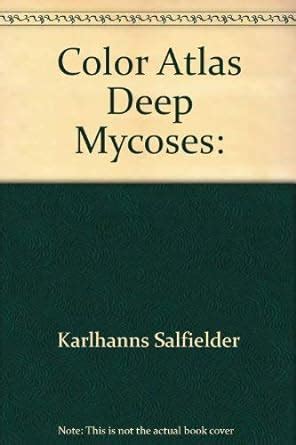 Atlas of Deep Mycoses : Amazon.in: Books