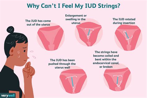 Intrauterine Device Iud