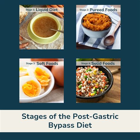 Important Dietary Guidelines After Gastric Bypass Surgery — Liquid Health