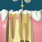 OROGOS - Complete Dental Clinic Gomti Nagar, Lucknow, India | dentist ...