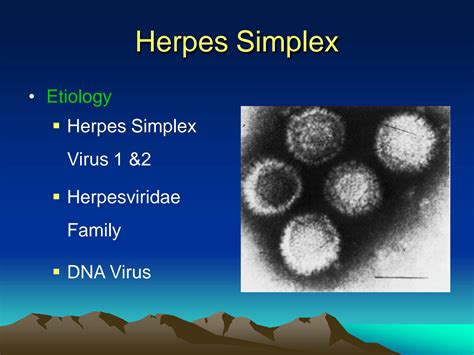 SOLUTION: Cutaneous viral innfections viral skin infections herpes ...
