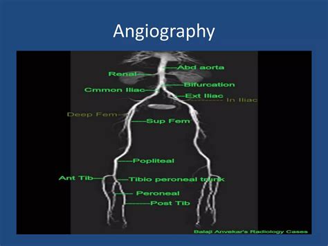 CHRONIC PERIPHERAL ARTERIAL OCCLUSIVE DISEASE | PPTX