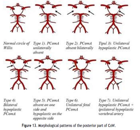 Image result for Program Flow for Lecture Sample