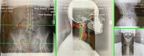 Body Alignment Test 的图像结果