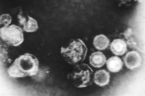 Electron micrograph of Epstein-Barr virus | Biology of Human/World of Viruses