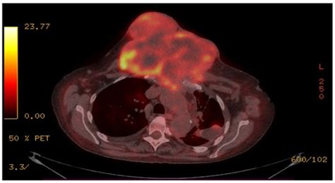 Healthcare | January 2022 - Browse Articles