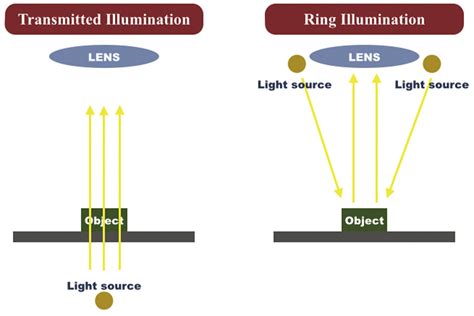 Image result for Transillumination