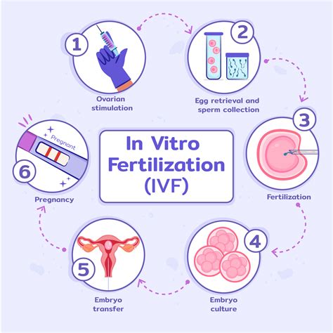 Image result for Vitro Fertilization IVF Process