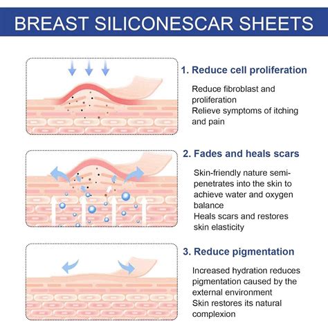 Silicone Scar Sheets for Breast - 8 Pack for Scar Removal After Breast Reduction - Includes 4 ...