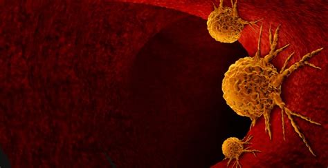 Image result for Cancer Detection Using Graph CNN