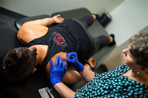 Basics of Trigger Point Dry Needling | Rose Physical Therapy Group