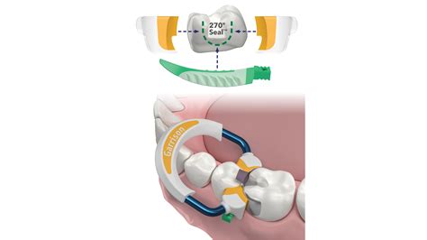 Image result for Sectional Matrix