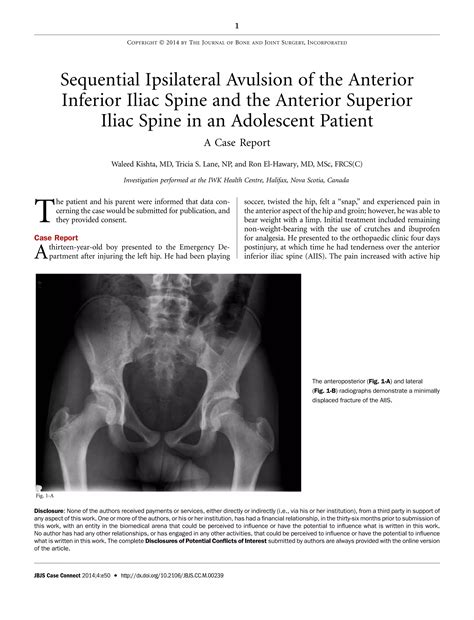 Sequential Ipsilateral Avulsion of the Anterior Inferior Iliac Spine ...