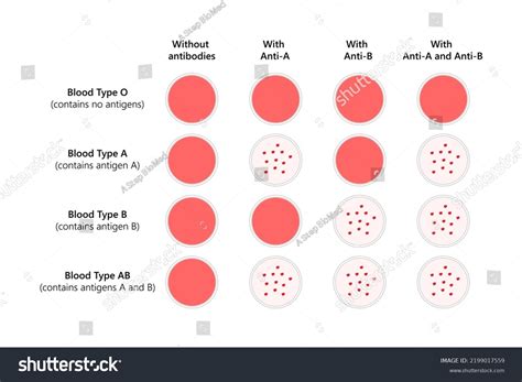 Tipificación de sangre de los tipos: vector de stock (libre de regalías ...