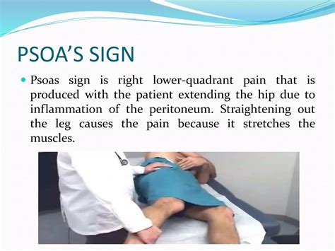 Image result for Psoas Sign Appendicitis