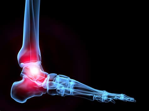 Ankle pain. Causes, symptoms, treatment Ankle pain