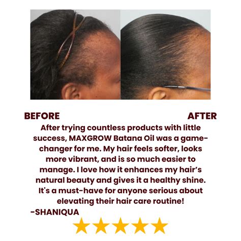 Batana Natural Hair Growth Oil - Maxgrow