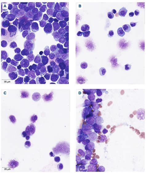 Image result for Lymphocyte Lineage Modulator