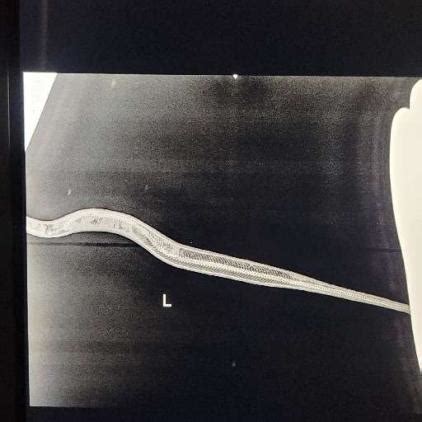 Sick Ball Python 的图像结果