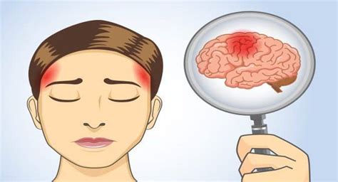 Brain tumour, ब्रेन ट्यूमर क्या है और इसके संकेत, लक्षण, कारण और उपचार ...