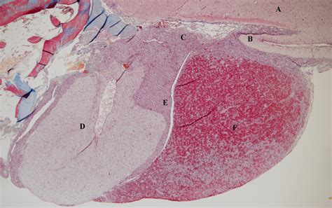 Infundibular Stalk Histology