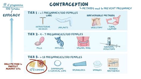 Contraceptive Methods 的图像结果