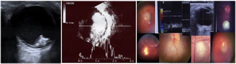 Articulo_Oftalmologia_18516