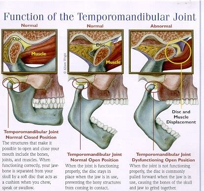 TMJ and Jaw Pain | Snider Chiropractic Center
