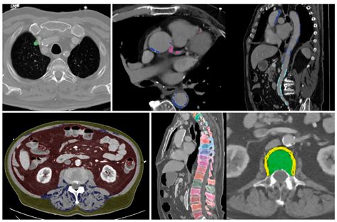 AI-Supported Comprehensive Detection and Quantification of Biomarkers ...