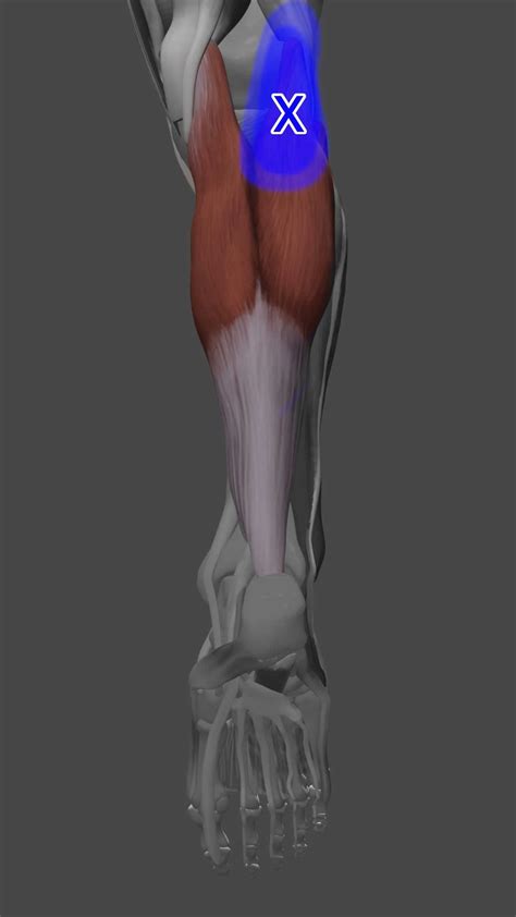 Acupuncture for Calf Trigger Points — Morningside Acupuncture NYC