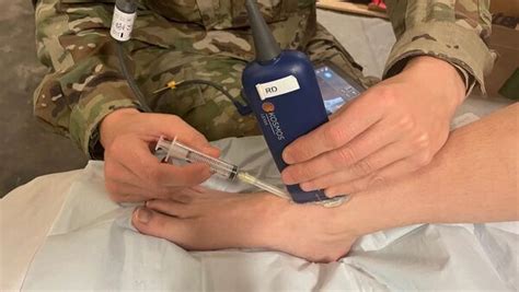 Image result for Ankle Injection Procedure