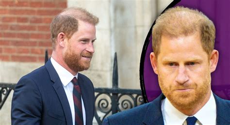 Prince Harry savagely told he 'needs a hair transplant' after balding ...