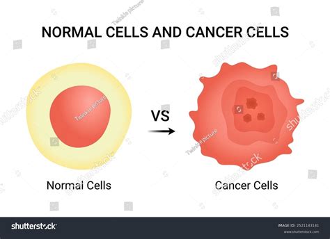 Image result for Normal vs Cancer Cells